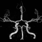 Angiographie ohne Kontrastmittel